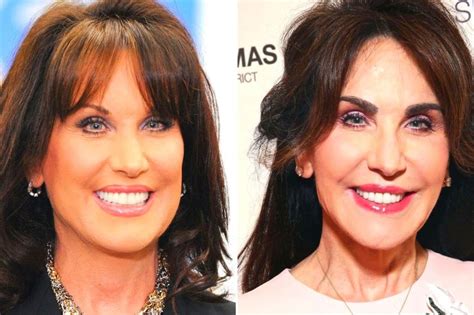 what happened to robin mcgraw's face.